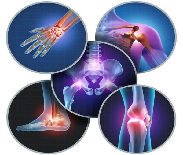 Cultura Física Terapéutica en afecciones del sistema osteomioarticular (SOMA).